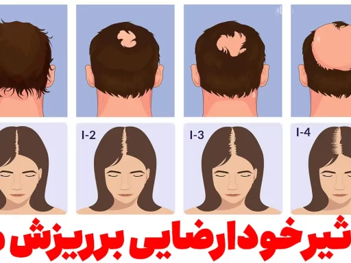 تاثیر خودارضایی بر ریزش مو